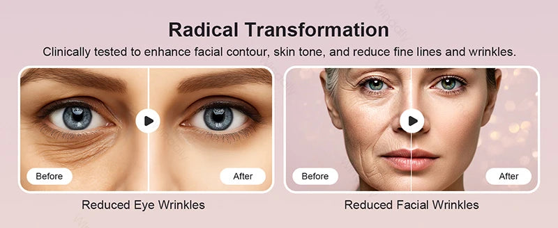 FlexWand Pro 4-in-1 Facial Device
